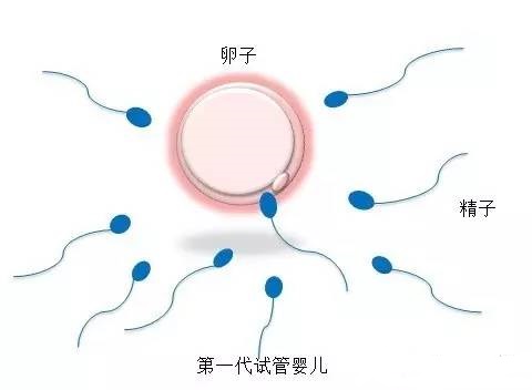 代生选性别包男孩